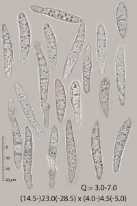 Durella macrospora