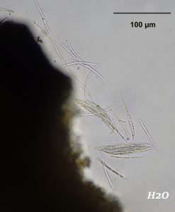 Neolamya peltigerae