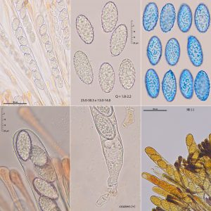 Scutellinia