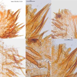 Scutellinia