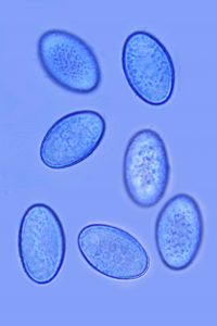 Scutellinia nigrohirtula (Svrček) Le Gal