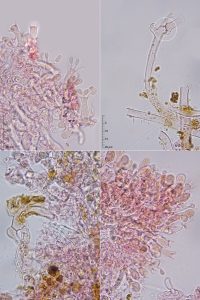 Sistotrema octosporum