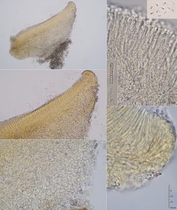 Orbilia xanthostigma