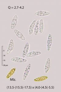 Chaetosphaeria innumera