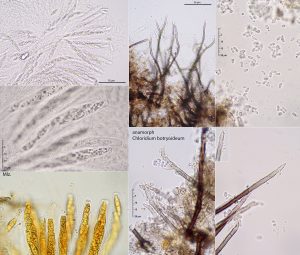 Chaetosphaeria innumera