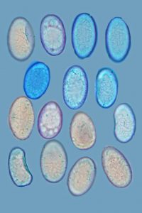 Neottiella aphanodictyon