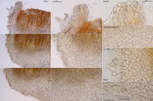 Neottiella aphanodictyon