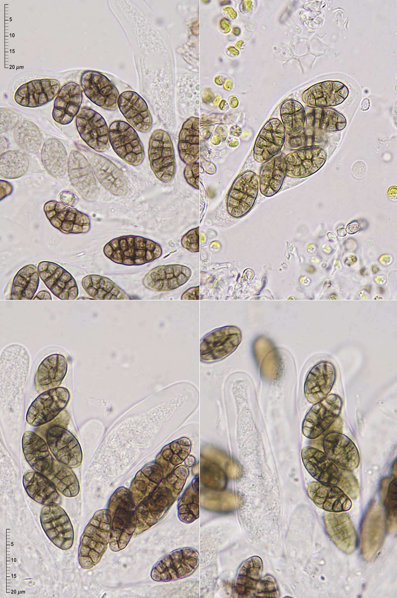 Capronia sp. ERD-9092 • CEMAS