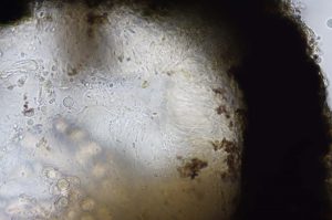 Verrucarria muralis
