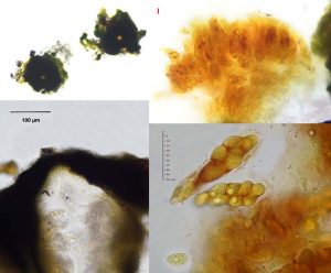 Verrucarria muralis