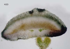 Placynthium nigrum