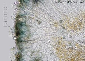 Placynthium nigrum