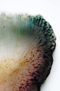 Placynthium nigrum