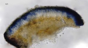 Placynthium nigrum