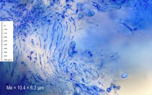 Lecanora albella