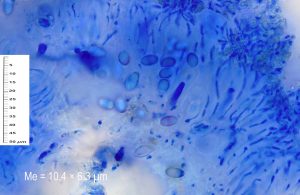 Lecanora albella