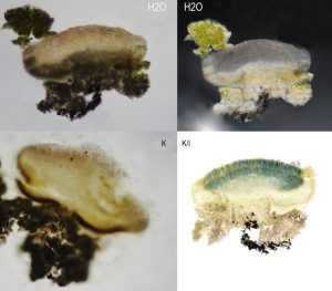 Trapeliopsis flexuosa