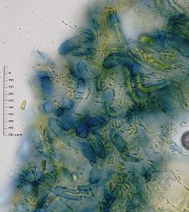 Trapeliopsis flexuosa
