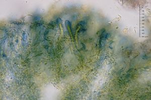 Trapeliopsis flexuosa