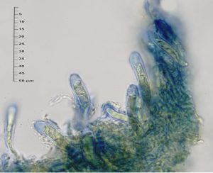 Trapeliopsis flexuosa