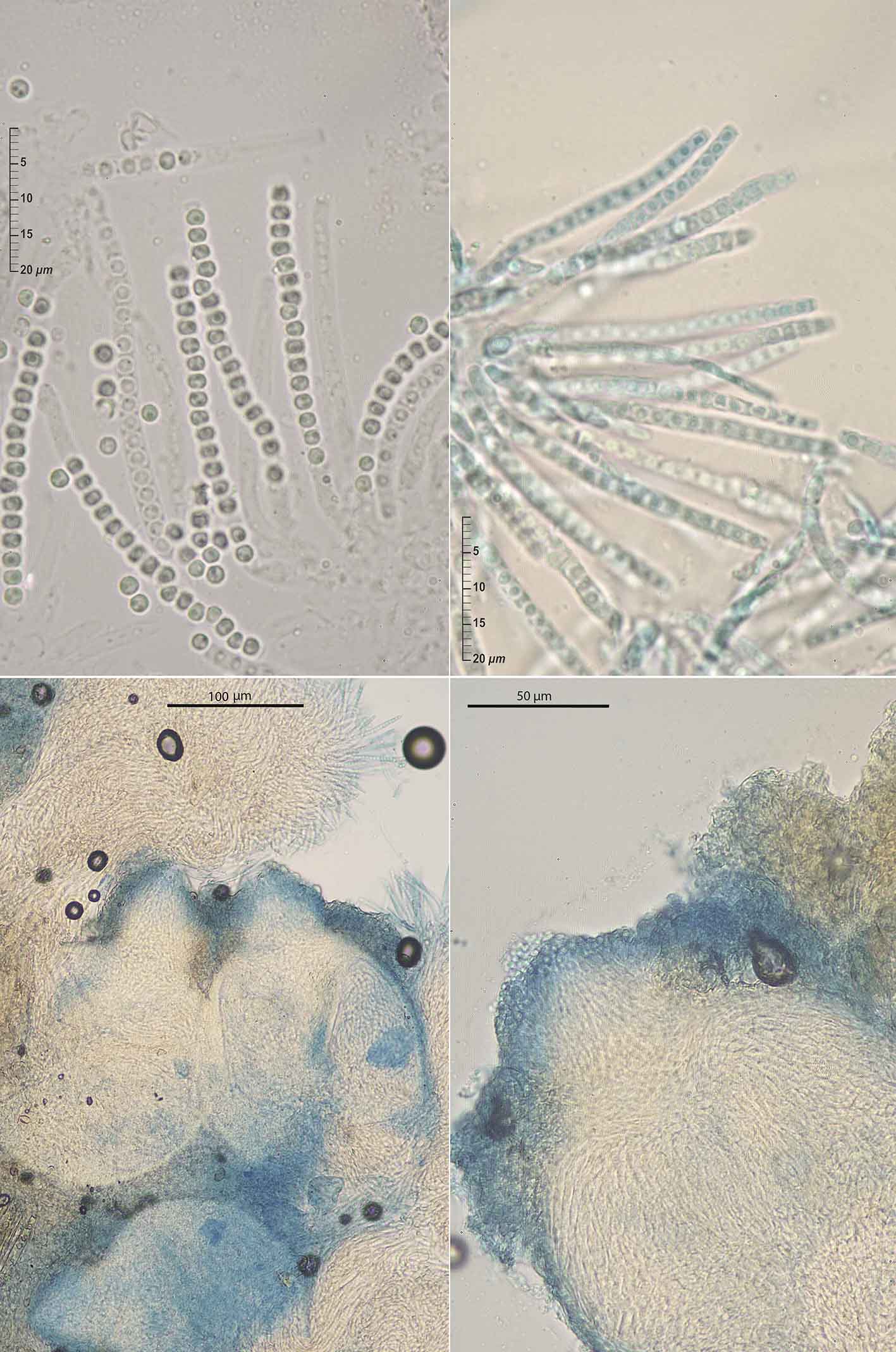 Trichoderma albolutescens Jaklitsch • CEMAS