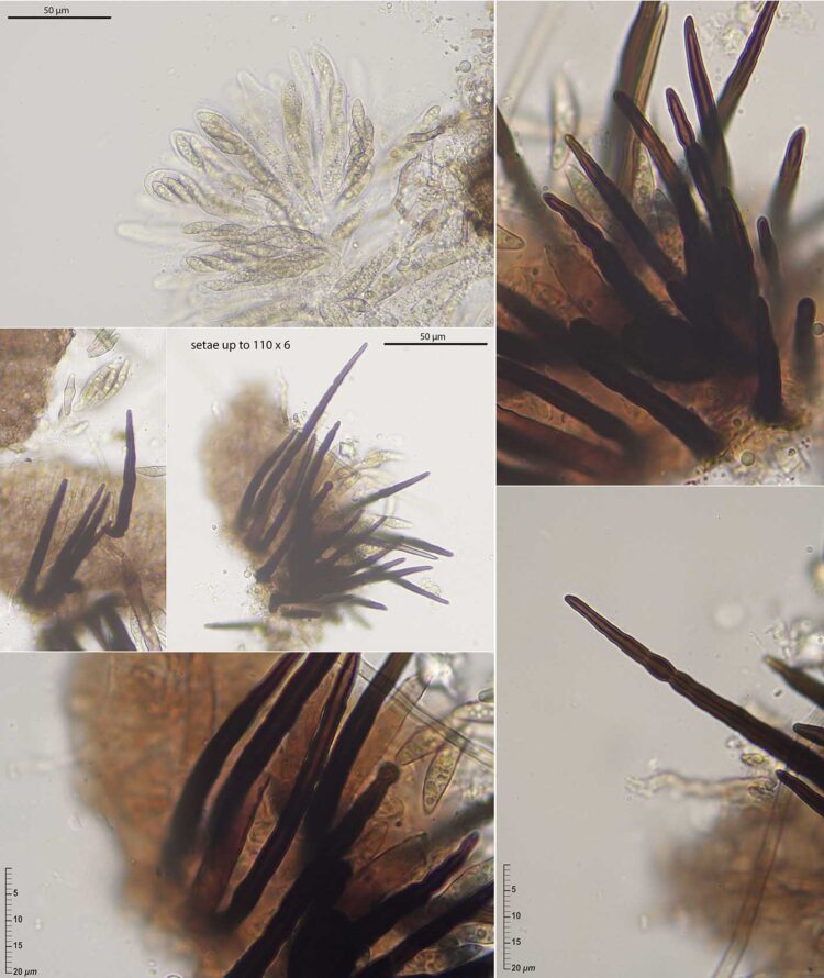 Capronia sp. ERD-10221 • CEMAS